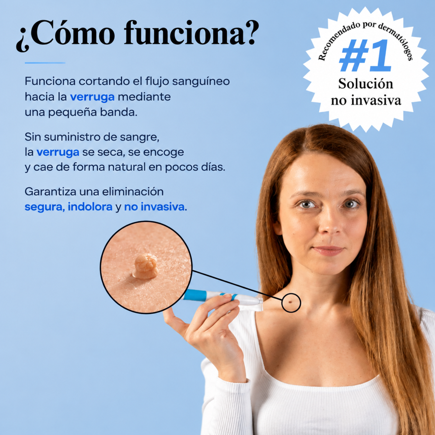 Kit Completo Eliminador de Verrugas