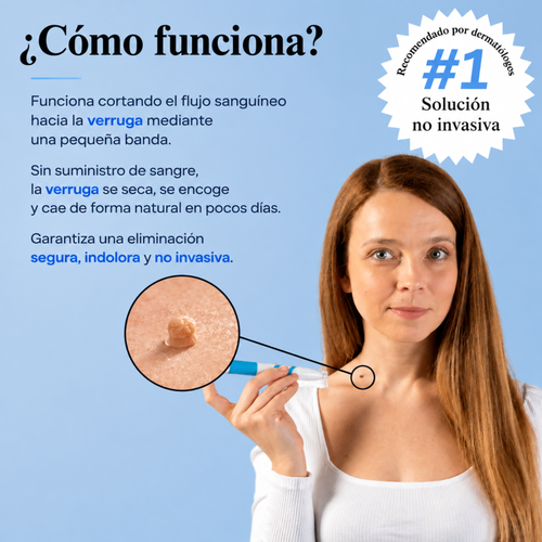 Kit Completo Eliminador de Verrugas